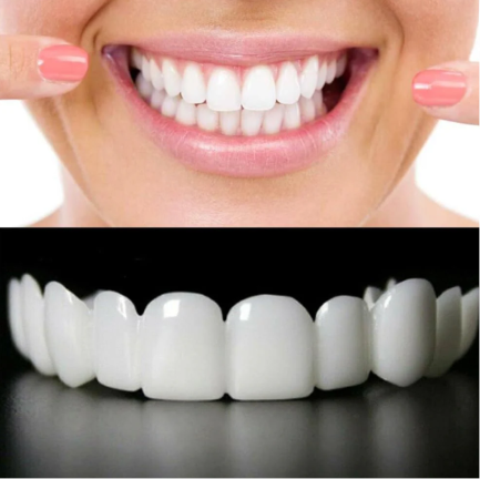 Snap On Smile - Instant Cosmetic Teeth Veneer